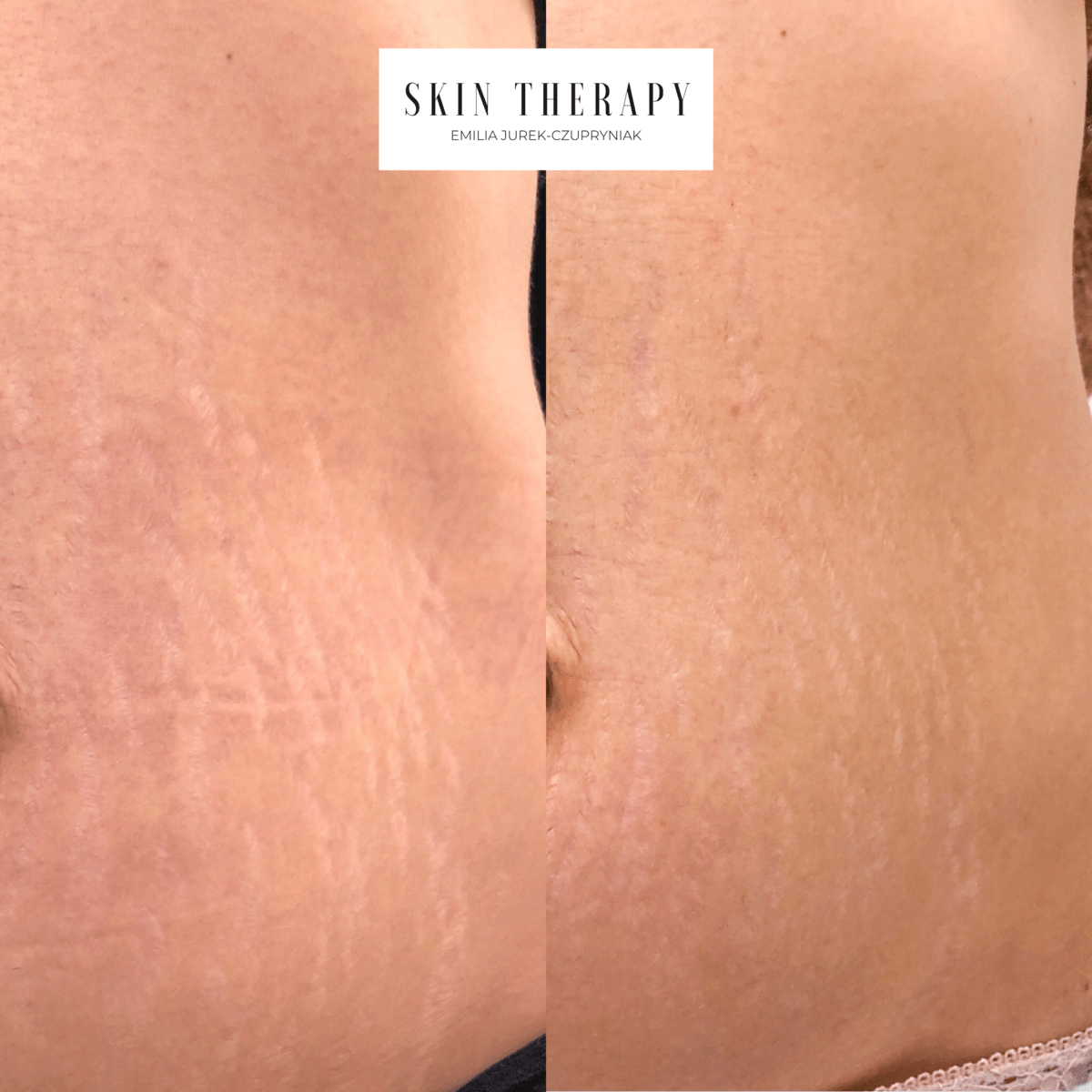 terapie skóry – 18