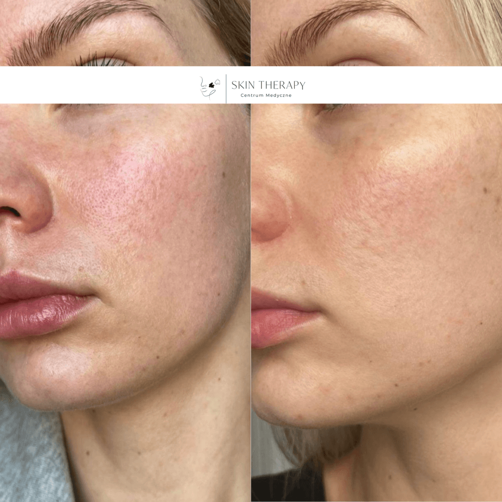 terapie skóry – 31