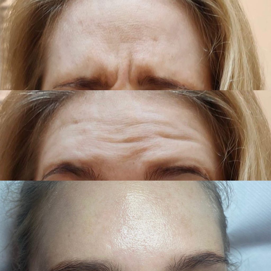 terapie skóry – 66