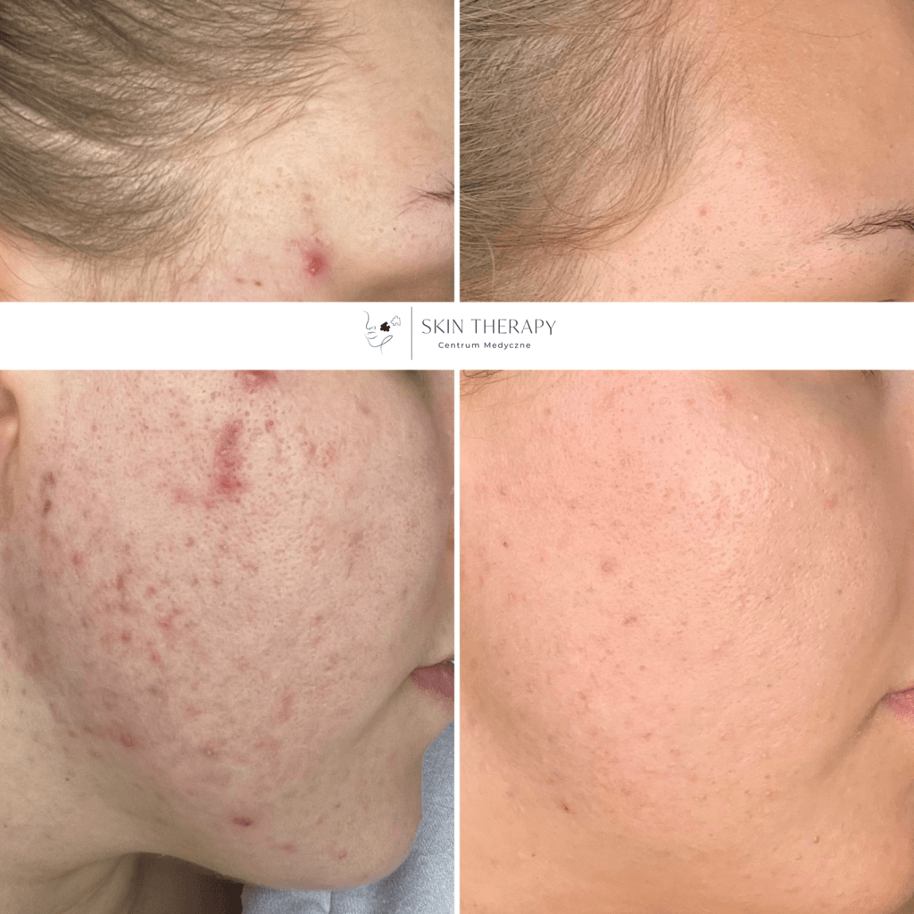 terapie skóry – 29