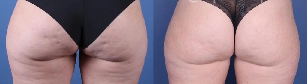 radiofrekwencja – 4