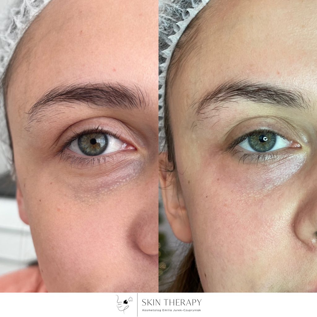 terapie skóry – 41