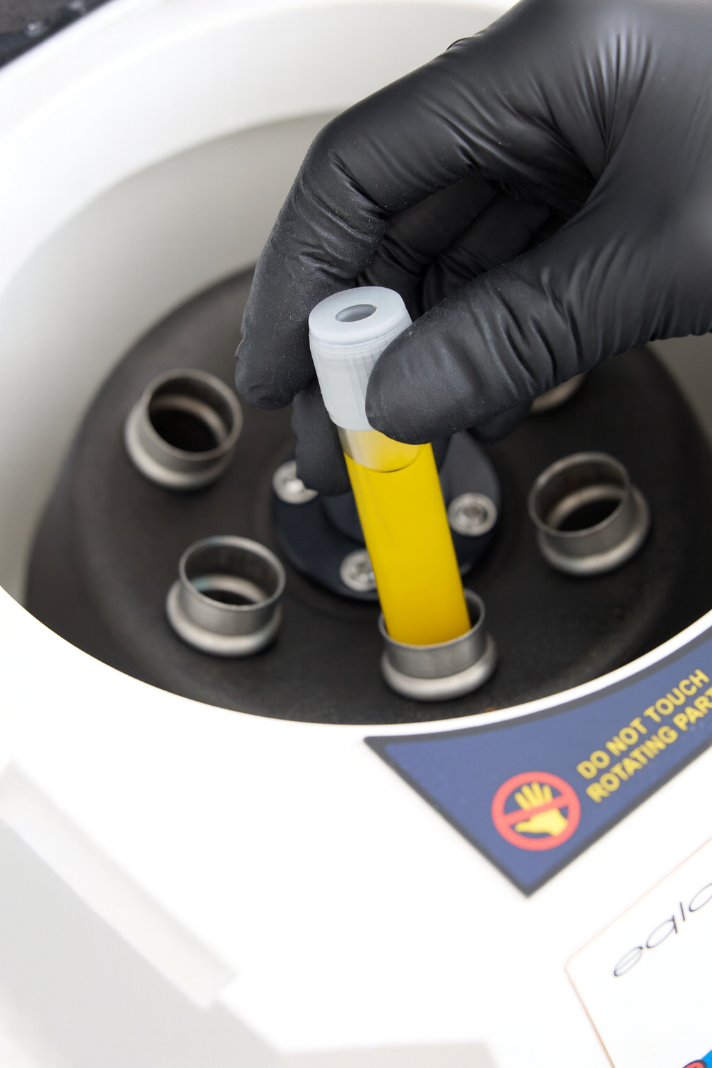 Osocze bogatopłytkowe