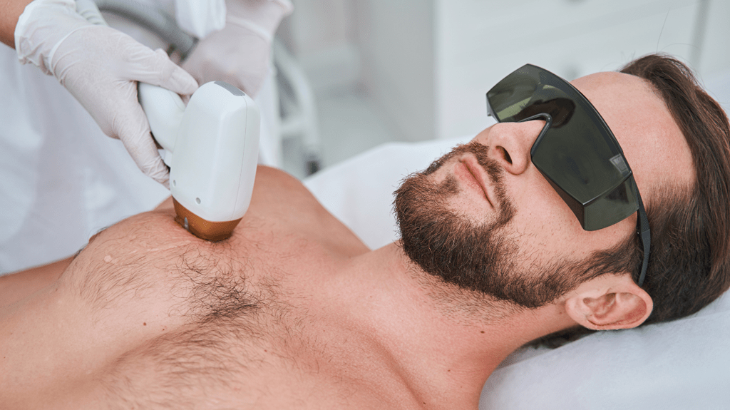 Depilacja laserowa dla mężczyzn